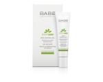 BABÉ STOP AKN SPOT CONTROL GEL, Vitsikupulk